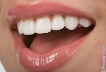 Приснились белые зубы: толкуем по сонникам