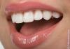 Ονειρεύτηκα λευκά δόντια: ερμηνεύστε τα από βιβλία ονείρων